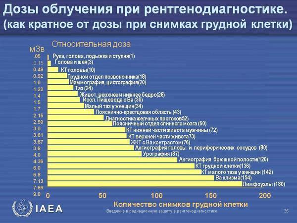 Рентген, КТ, МРТ и УЗИ — в чем разница?